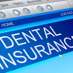 Dental-Insurance-Are-You-Underbilling