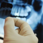 Dental XRay Certification - PPO Credentialing & Recredentialing - Top PPO Negotiator - Dental PPO Consultants