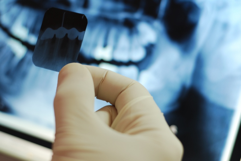 Dental XRay Certification - Top Dental PPO Negotiator